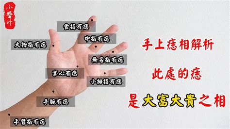 中指有痣|手痣位置 10種手痣位置 解析，揭示你的命運秘密